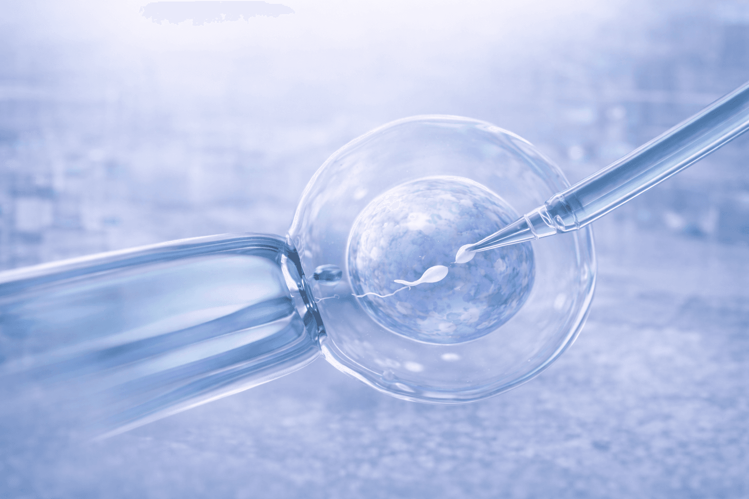 In Vitro Fertilization (IVF)